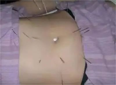轻度亚健康症状_轻度亚健康是什么意思_轻度亚健康和重度疲劳
